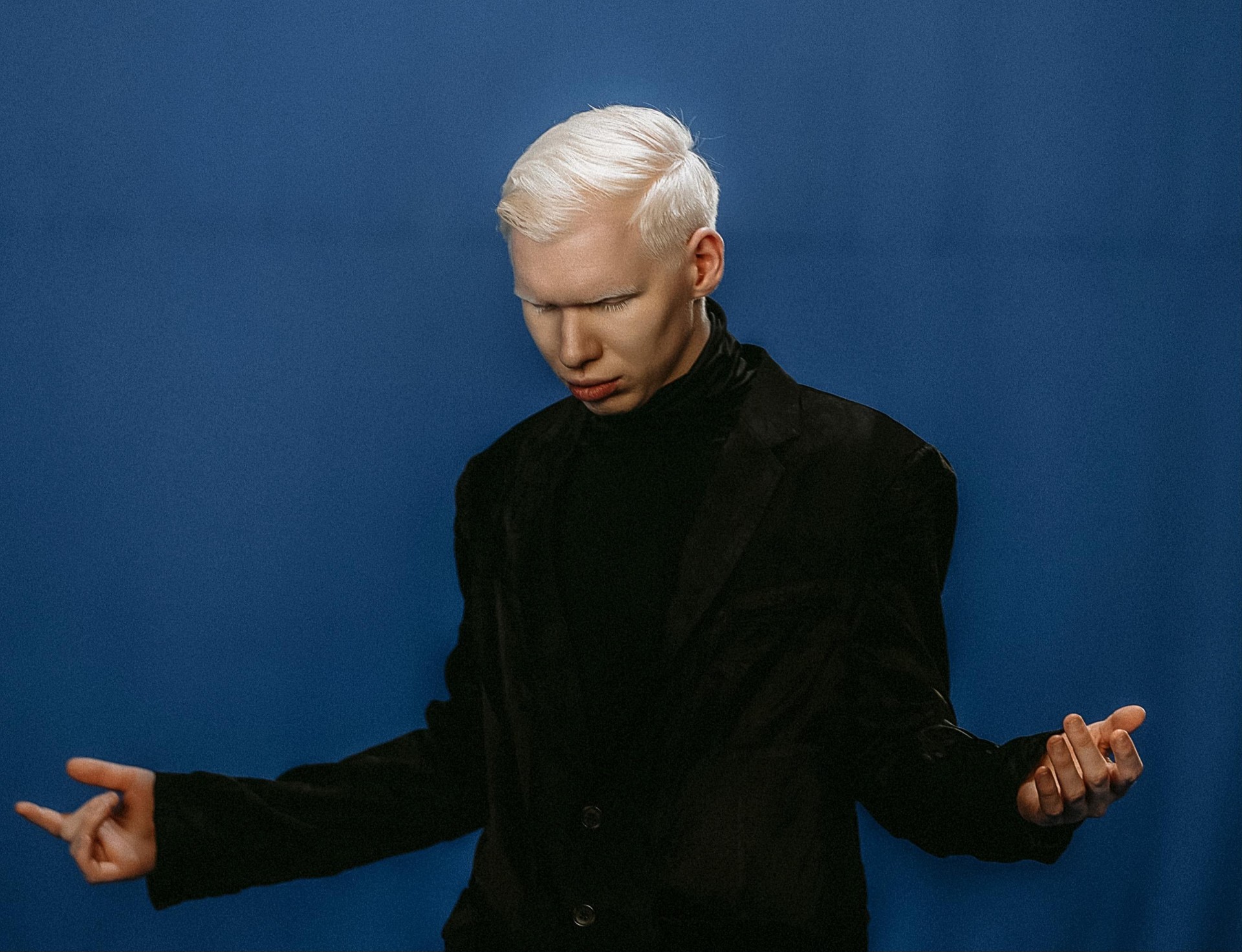 thumbnail_Albino_image_3.jpg